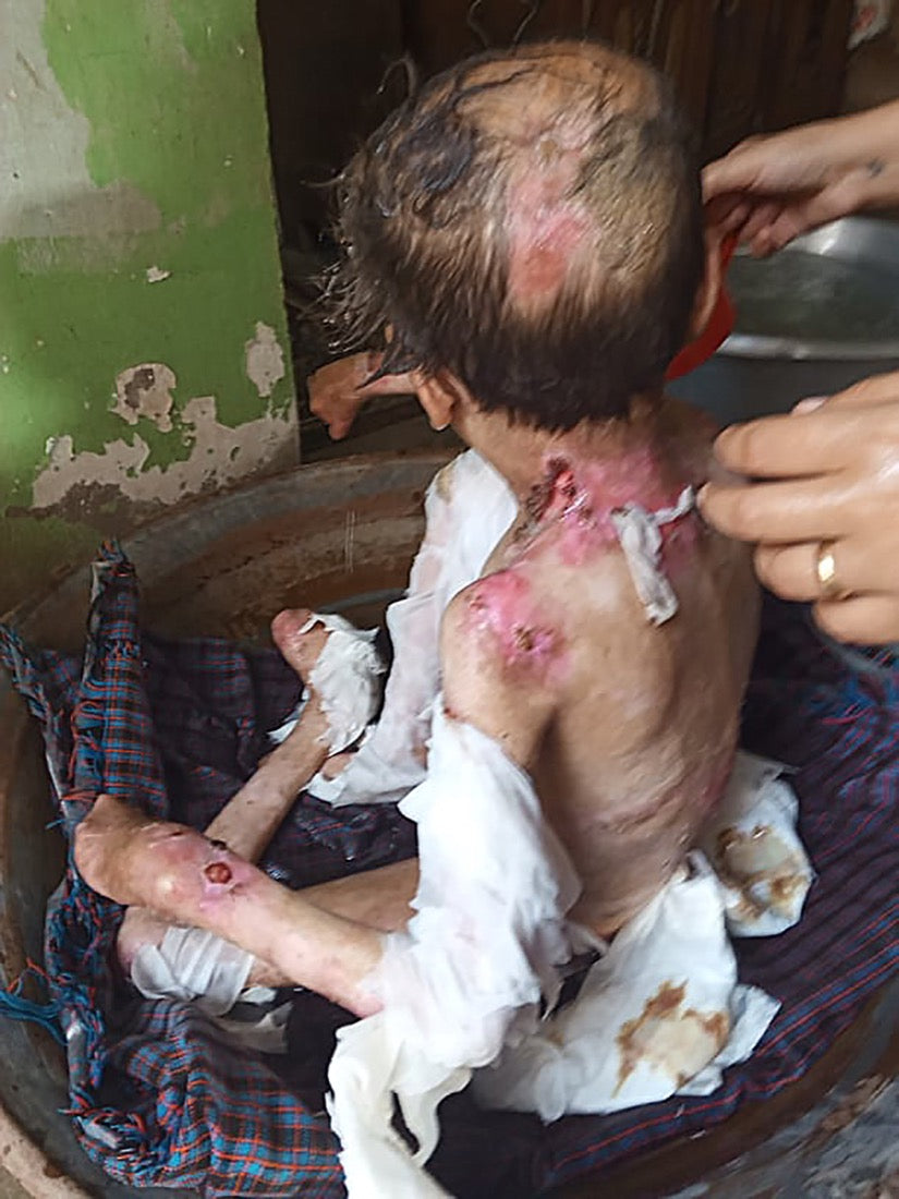 Donate_Now_Baby-Alfred-compressed