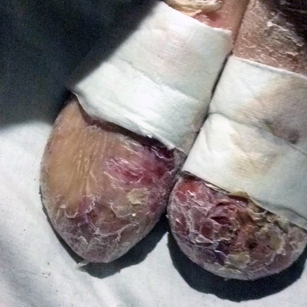 Ashley's Feet